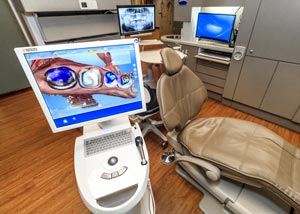 CEREC Same Day Crowns Dentist Grand Rapids