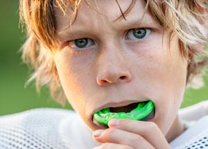 Sports Mouthguards Dentist Grand Rapids